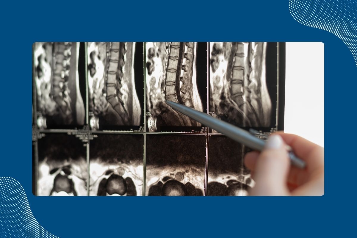 Orthopedic Surgeon vs. Neurosurgeon Which Doctor is Right for You?