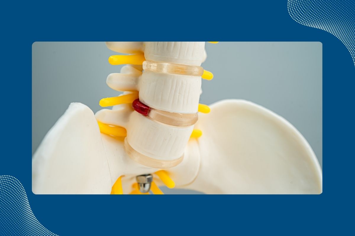 can-a-bulging-disc-get-worse-understanding-a-bulging-disc